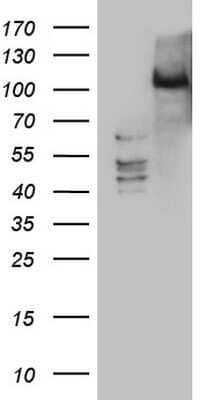 Western Blot: PRKD3/nPKC nu Antibody (OTI3D8) - Azide and BSA Free [NBP2-73595] - Analysis of HEK293T cells were transfected with the pCMV6-ENTRY control (Left lane) or pCMV6-ENTRY PRKD3.