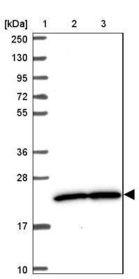 Western Blot: PRKRIP1 Antibody [NBP2-13811] - Lane 1: Marker  [kDa] 250, 130, 95, 72, 55, 36, 28, 17, 10.  Lane 2: Human cell line RT-4.  Lane 3: Human cell line U-251MG sp