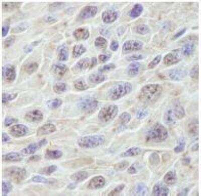 Immunohistochemistry-Paraffin: PRKRIR Antibody [NB100-1555] - FFPE section of mouse squamous cell carcinoma.  Affinity purified rabbit anti-PRKRIR used at a dilution of 1:250.