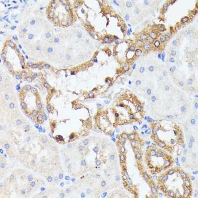 Immunohistochemistry-Paraffin: PRL-2/PTP4A2 Antibody [NBP2-93937] -  Rat kidney using PTP4A2 antibody at dilution of 1:100 (40x lens).Perform microwave antigen retrieval with 10 mM PBS buffer pH 7.2 before commencing with IHC staining protocol.