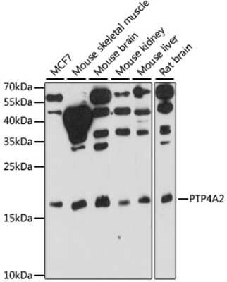 Western Blot: PRL-2/PTP4A2 Antibody [NBP2-93937] - Analysis of extracts of various cell lines, using PRL-2/PTP4A2 at 1:1000 dilution. Secondary antibody: HRP Goat Anti-Rabbit IgG (H+L) at 1:10000 dilution. Lysates/proteins: 25ug per lane. Blocking buffer: 3% nonfat dry milk in TBST. Detection: ECL Basic Kit . Exposure time: 30s.