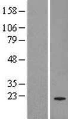 Western Blot: PRL-3 Overexpression Lysate (Adult Normal) [NBL1-14961] Left-Empty vector transfected control cell lysate (HEK293 cell lysate); Right -Over-expression Lysate for PRL-3.