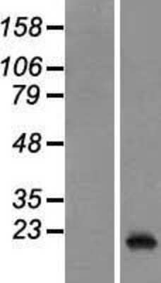 Western Blot: PRL-3 Overexpression Lysate (Adult Normal) [NBP2-05990] Left-Empty vector transfected control cell lysate (HEK293 cell lysate); Right -Over-expression Lysate for PRL-3.