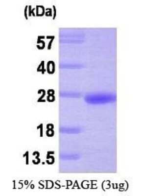 SDS-Page: Recombinant Human PRL-3/PTP4A3 Protein [NBP1-30246] - PRL-3, 21.6 kDa (193aa), confirmed by MALDI-TOF with a purity of 95% by SDS - PAGE