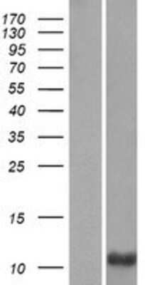 Western Blot PRM3 Overexpression Lysate