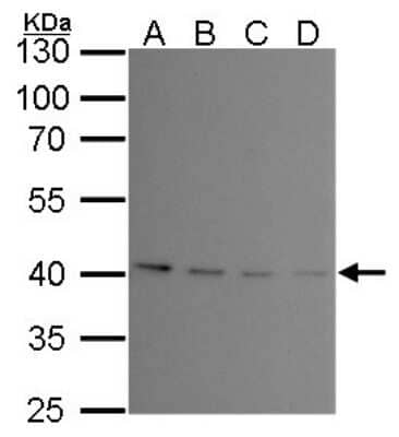 Western Blot: PRMT1 Antibody (10111) [NBP2-43818] - Analysis of A 293T whole cell lysate/extract B A431 whole cell lysate/extract C HeLa whole cell lysate/extract D HepG2 whole cell lysate/extract 10 % SDS-PAGE PRMT1 antibody [10111] dilution: 1:1000