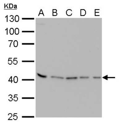 Western Blot: PRMT1 Antibody (10111) [NBP2-43818] - Analysis of A. 30 ug Neuro2A whole cell lysate/extract B. 30 ug GL261 whole cell lysate/extract C. 30 ug NIH-3T3 whole cell lysate/extract D. 30 ug Raw264.7 whole cell lysate/extract E. 30 ug C2C12 whole cell lysate/extract 10 % SDS-PAGE PRMT1 antibody [10111] dilution: 1:1000.