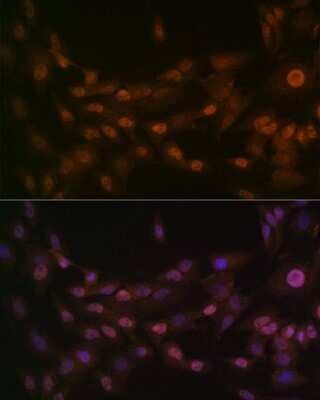 Immunocytochemistry/Immunofluorescence: PRMT1 Antibody (10W10U4) [NBP3-16423] - Immunofluorescence analysis of C6 cells using PRMT1 Rabbit mAb (NBP3-16423) at dilution of 1:100 (40x lens). Blue: DAPI for nuclear staining.