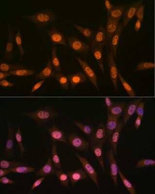 Immunocytochemistry/Immunofluorescence: PRMT1 Antibody (10W10U4) [NBP3-16423] - Immunofluorescence analysis of NIH-3T3 cells using PRMT1 Rabbit mAb (NBP3-16423) at dilution of 1:100 (40x lens). Blue: DAPI for nuclear staining.