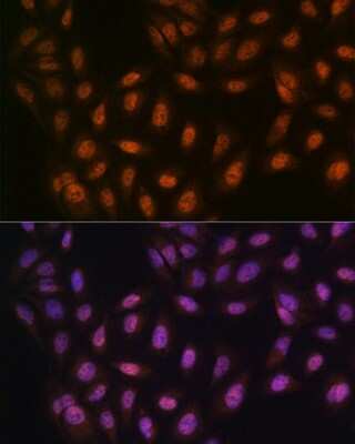 Immunocytochemistry/Immunofluorescence: PRMT1 Antibody (10W10U4) [NBP3-16423] - Immunofluorescence analysis of U-2 OS cells using PRMT1 Rabbit mAb (NBP3-16423) at dilution of 1:100 (40x lens). Blue: DAPI for nuclear staining.