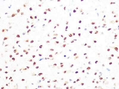 Immunohistochemistry-Paraffin: PRMT1 Antibody (10W10U4) [NBP3-16423] - Immunohistochemistry of paraffin-embedded rat brain using PRMT1 Rabbit mAb (NBP3-16423) at dilution of 1:100 (40x lens).Perform microwave antigen retrieval with 10 mM PBS buffer pH 7.2 before commencing with IHC staining protocol.