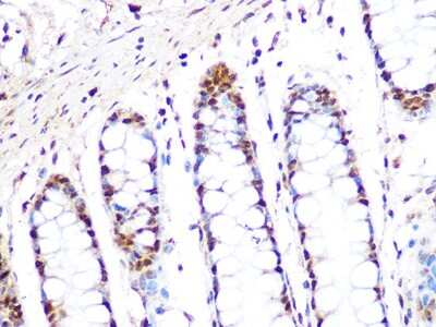 Immunohistochemistry-Paraffin: PRMT1 Antibody (10W10U4) [NBP3-16423] - Immunohistochemistry of paraffin-embedded human colon using PRMT1 Rabbit mAb (NBP3-16423) at dilution of 1:100 (40x lens).Perform microwave antigen retrieval with 10 mM PBS buffer pH 7.2 before commencing with IHC staining protocol.