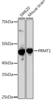 Western Blot: PRMT1 Antibody (10W10U4) [NBP3-16423] - Western blot analysis of extracts of various cell lines, using PRMT1 Rabbit mAb (NBP3-16423) at 1:1000 dilution. Secondary antibody: HRP Goat Anti-Rabbit IgG (H+L) at 1:10000 dilution. Lysates/proteins: 25ug per lane. Blocking buffer: 3% nonfat dry milk in TBST. Detection: ECL Enhanced Kit. Exposure time: 3min.