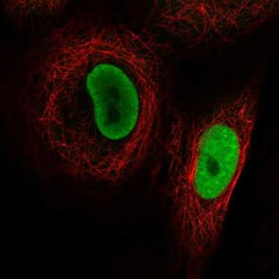 Immunocytochemistry/Immunofluorescence: PRMT1 Antibody [NBP2-58031] - Staining of human cell line A549 shows localization to nucleoplasm.