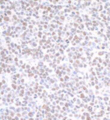 Immunohistochemistry-Paraffin: PRMT1 Antibody [NB100-2251] - Section of mouse plasmacytoma. Antibody: Affinity purified rabbit anti- PRMT1 used at a dilution of 1:200 (1 ug/ml). Detection: DAB