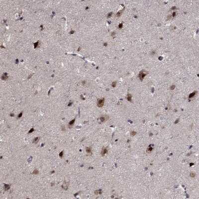 Immunohistochemistry-Paraffin: PRMT1 Antibody [NBP2-57768] - Immunohistochemical staining of human cerebral cortex shows strong nuclear positivity in a subset of neuronal cells.