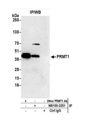 <b>Independent Antibodies Validation. </b>Immunoprecipitation: PRMT1 Antibody [NB100-2251] - Detection of human PRMT1 by western blot of immunoprecipitates. Samples: Whole cell lysate (1.0 mg per IP reaction; 20% of IP loaded) from HEK293T cells prepared using NETN lysis buffer + 0.3% SDS, 1.5% sodium deoxycholate. Antibodies: Affinity purified rabbit anti-PRMT1 antibody NB100-2251 (lot NB100-2251-2) used for IP at 3 ug per reaction. PRMT1 was also immunoprecipitated by another rabbit anti-PRMT1 antibody. For blotting immunoprecipitated PRMT1, NB100-2251 was used at 1 ug/ml. Detection: Chemiluminescence with an exposure time of 75 seconds.