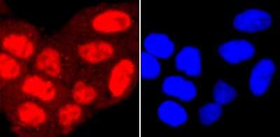 Immunocytochemistry/Immunofluorescence: PRMT1 Antibody (JA11-17) [NBP2-67074] - Staining PRMT1 in Hela cells (red). The nuclear counter stain is DAPI (blue). Cells were fixed in paraformaldehyde, permeabilised with 0.25% Triton X100/PBS.