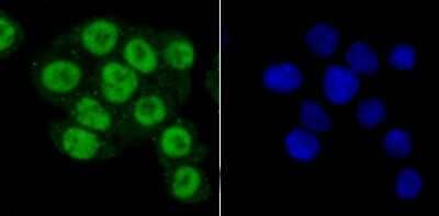 Immunocytochemistry/Immunofluorescence: PRMT1 Antibody (JA11-17) [NBP2-67074] - Staining PRMT1 in SW480 cells (green). The nuclear counter stain is DAPI (blue). Cells were fixed in paraformaldehyde, permeabilised with 0.25% Triton X100/PBS.