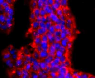 Immunocytochemistry/Immunofluorescence: PRMT1 Antibody (JA11-17) [NBP2-67074] - Staining PRMT1 in D3 cells (red). The nuclear counter stain is DAPI (blue). Cells were fixed in paraformaldehyde, permeabilised with 0.25% Triton X100/PBS.