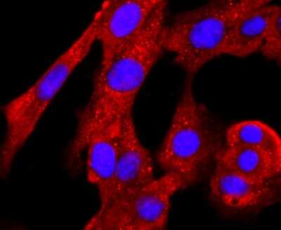 Immunocytochemistry/Immunofluorescence: PRMT1 Antibody (JA11-17) [NBP2-67074] - Staining PRMT1 in NIH-3T3 cells (red). The nuclear counter stain is DAPI (blue). Cells were fixed in paraformaldehyde, permeabilised with 0.25% Triton X100/PBS.