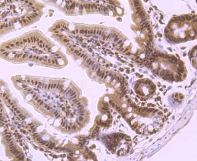 Immunohistochemistry-Paraffin: PRMT1 Antibody (JA11-17) [NBP2-67074] - Analysis of paraffin-embedded mouse colon tissue using anti-PRMT1 antibody. Counter stained with hematoxylin.