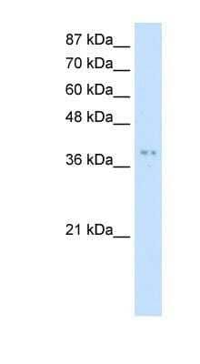 Western Blot: PRMT1 Antibody [NBP1-56501] - Jurkat cell lysate, Antibody Titration: 5.0ug/ml