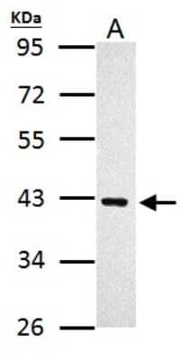 Western Blot: PRMT1 Antibody [NBP2-19300] - Sample (30 ug of whole cell lysate) A: A431 10% SDS PAGE gel, diluted at 1:2000.