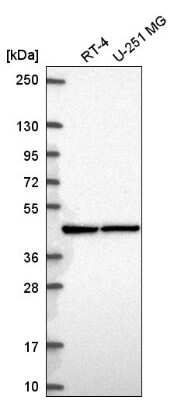 Western Blot: PRMT1 Antibody [NBP2-57768] - Western blot analysis in human cell line RT-4 and human cell line U-251 MG.