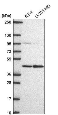 Western Blot: PRMT1 Antibody [NBP2-58031] - Western blot analysis in human cell line RT-4 and human cell line U-251 MG.