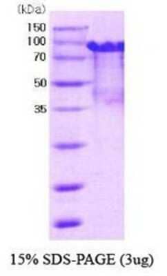 SDS-PAGE Recombinant Mouse PRMT1 His-MBP Protein