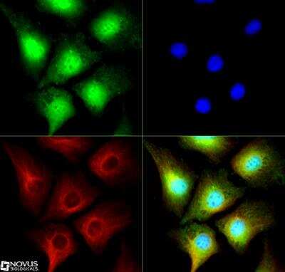 Immunocytochemistry/Immunofluorescence: PRMT2 Antibody [NB110-93593] - PRMT2 antibody was tested in Hela cells with DyLight 488 (green). Nuclei and alpha-tubulin were counterstained with DAPI (blue) and Dylight 550 (red).
