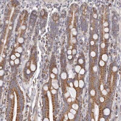 Immunohistochemistry-Paraffin: PRMT2 Antibody [NBP1-83207] - Staining of human duodenum shows strong cytoplasmic positivity in glandular cells.