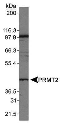 Western Blot: PRMT2 Antibody [NB110-93593] - Detection of PRMT2 in Jurkat whole cell lysates using NB110-93593.