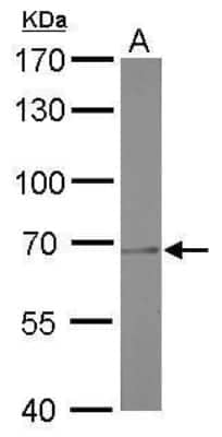 Western Blot: PRMT5 Antibody (3610) [NBP2-43678] - Analysis of A. 50 ug rat kidney lysate/extract 7.5 % SDS-PAGE PRMT5 antibody [3610] dilution: 1:1000.