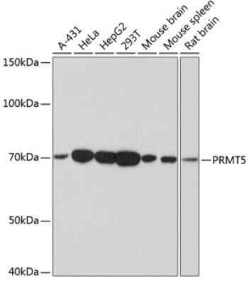 Western Blot: PRMT5 Antibody (7K2G5) [NBP3-15758] - Western blot analysis of extracts of various cell lines, using PRMT5 antibody (NBP3-15758) at 1:1000 dilution. Secondary antibody: HRP Goat Anti-Rabbit IgG (H+L) at 1:10000 dilution. Lysates/proteins: 25ug per lane. Blocking buffer: 3% nonfat dry milk in TBST. Detection: ECL Basic Kit. Exposure time: 3min.