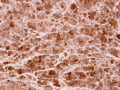 Immunohistochemistry-Paraffin: PRMT5 Antibody [NBP2-19935] - MCF7 xenograft, using PRMT5 antibody at 1:100 dilution. Antigen Retrieval: Trilogy™ (EDTA based, pH 8.0) buffer, 15min.