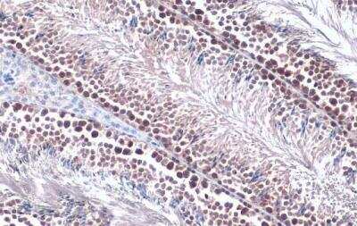 Immunohistochemistry-Paraffin: PRMT5 Antibody [NBP2-19935] - Mouse testis. PRMT5 stained by PRMT5 antibody [N1C1] diluted at 1:500.Antigen Retrieval: Citrate buffer, pH 6.0, 15 min. 