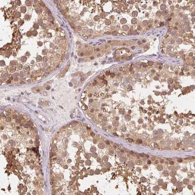 Immunohistochemistry-Paraffin: PRMT5 Antibody [NBP2-56041] - Immunohistochemical staining of human testis shows moderate cytoplasmic and nuclear positivity in cells in seminiferous ducts and Leydig cells.