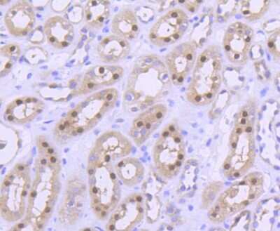 Immunohistochemistry-Paraffin: PRMT5 Antibody (ST51-06) [NBP2-67515] - Analysis of paraffin-embedded human kidney tissue using anti-PRMT5 antibody. Counter stained with hematoxylin.