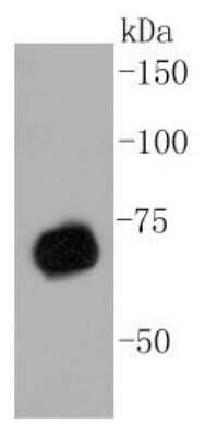 Western Blot: PRMT5 Antibody (ST51-06) [NBP2-67515] - Analysis of PRMT5 on A431 cell lysates using anti-PRMT5 antibody at 1/1,000 dilution.