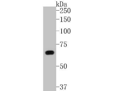 Western Blot: PRMT5 Antibody (ST51-06) [NBP2-67515] - Western blot analysis of PRMT5 on A431 cell lysates. Proteins were transferred to a PVDF membrane and blocked with 5% BSA in PBS for 1 hour at room temperature. The primary antibody (1/500) was used in 5% BSA at room temperature for 2 hours. Goat Anti-Rab