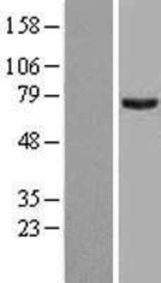 Western Blot: PRMT5 Overexpression Lysate (Adult Normal) [NBL1-14795] Left-Empty vector transfected control cell lysate (HEK293 cell lysate); Right -Over-expression Lysate for PRMT5.