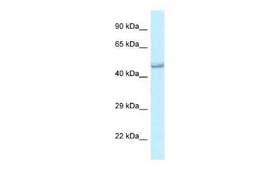 Western Blot: PRMT6 Antibody [NBP2-88091] - WB Suggested Anti-Prmt6 Antibody. Titration: 1.0 ug/ml. Positive Control: Rat Muscle