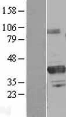 Western Blot PRMT6 Overexpression Lysate