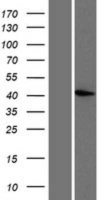 Western Blot PRMT6 Overexpression Lysate