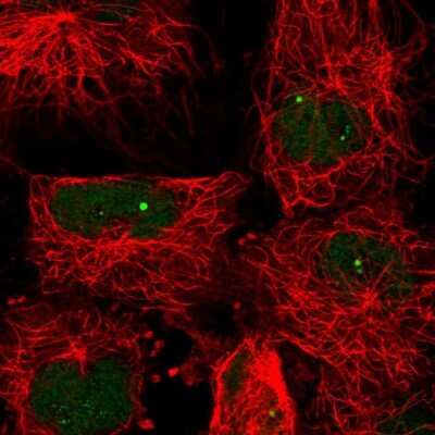 Immunocytochemistry/Immunofluorescence: PRMT7 Antibody [NBP2-47322] - Staining of human cell line U-251 MG shows localization to nucleoplasm & nucleoli fibrillar center.