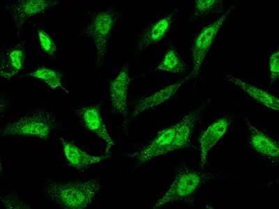 Immunocytochemistry/Immunofluorescence: PRMT7 Antibody [NBP2-98849] - Immunofluorescence staining of PRMT7 in HeLa cells. Cells were fixed with 4% PFA, permeabilzed with 0.3% Triton X-100 in PBS, blocked with 10% serum, and incubated with rabbit anti-human PRMT7 polyclonal antibody (1:1000) at 4C overnight. Then cells were stained with the Alexa Fluor(R)488-conjugated Goat Anti-rabbit IgG secondary antibody (green).Positive staining was localized to cytoplasm and nucleus.