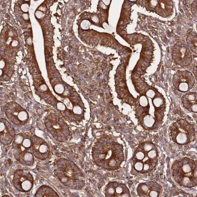 Immunohistochemistry: PRMT7 Antibody [NBP2-47322] - Staining of human duodenum shows strong cytoplasmic and membranous positivity in glandular cells.