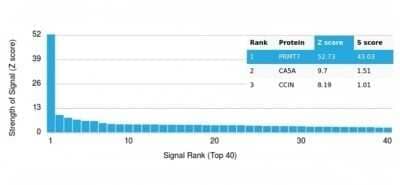 Protein Array: PRMT7 Antibody (PCRP-PRMT7-1A4) - Azide and BSA Free [NBP3-14144] - Analysis of Protein Array containing more than 19,000 full-length human proteins using PRMT7 Antibody (PCRP-PRMT7-1A4).